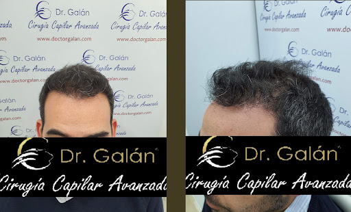 Doctor Galán